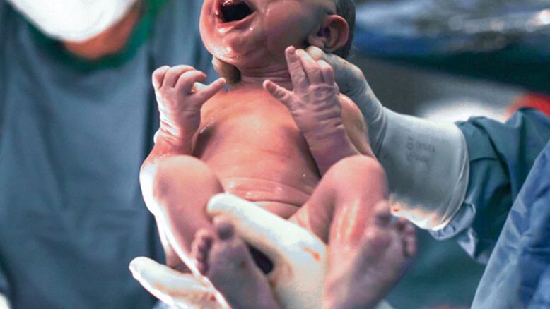 Noworodka zoperowano w drugiej dobie życia