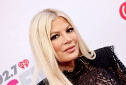 Tori Spelling bolało oko. Diagnoza ją przeraziła