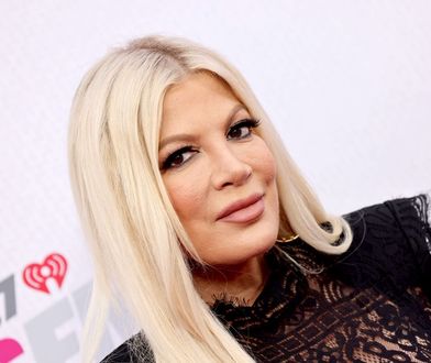 Tori Spelling bolało oko. Diagnoza ją przeraziła