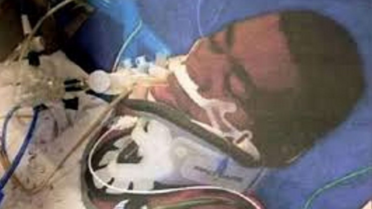 Jean-Pierre Adams w śpiączce