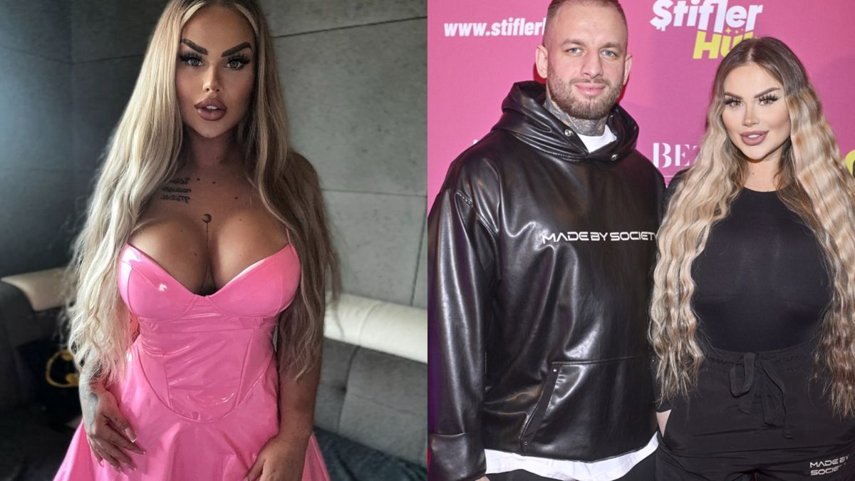 Ewelona opowiedziała o operacjach plastycznych