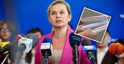 Czerwony pasek do likwidacji? Ministra edukacji mówi wprost