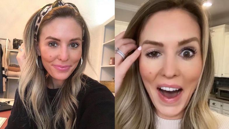 Influencerka oszpecona nieudanym botoksem