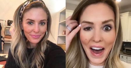 Influencerka OSZPECONA po nieudanym botoksie: "Wyglądam jak Dwie Twarze!"