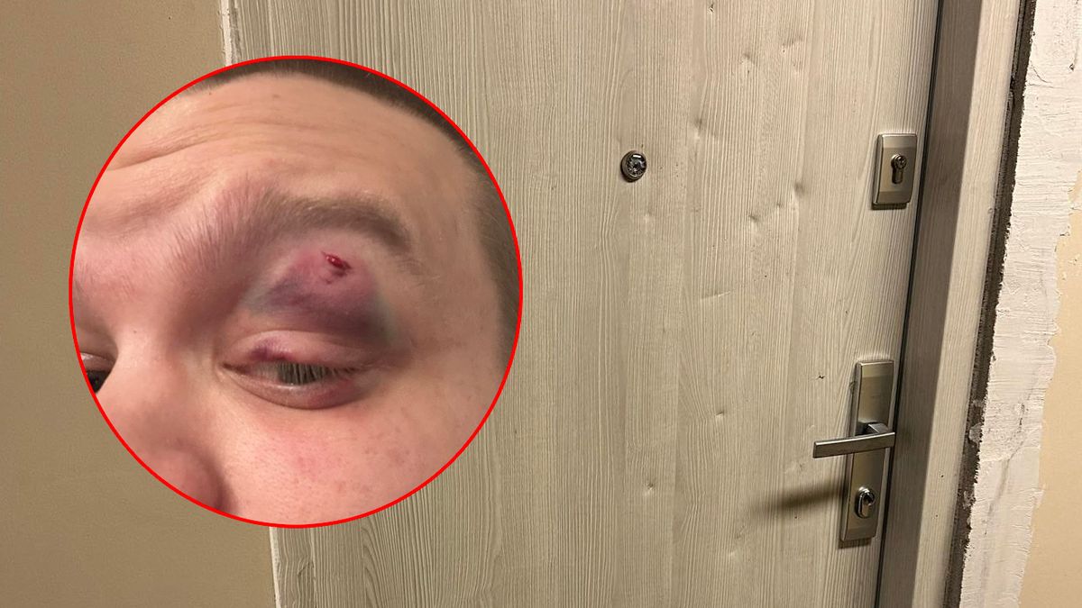 Polak został pobity przez obcokrajowca. W swoim domu