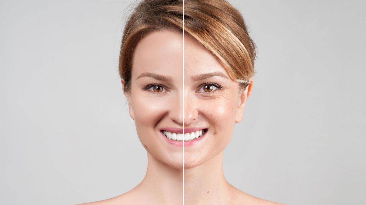 Thermo-lifting twarzy RF