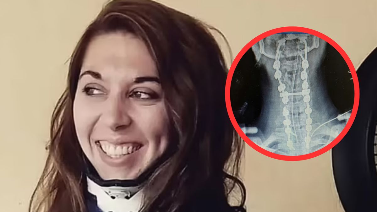 Głowa Megan jest dosłownie "przyspawana" do jej kręgosłupa