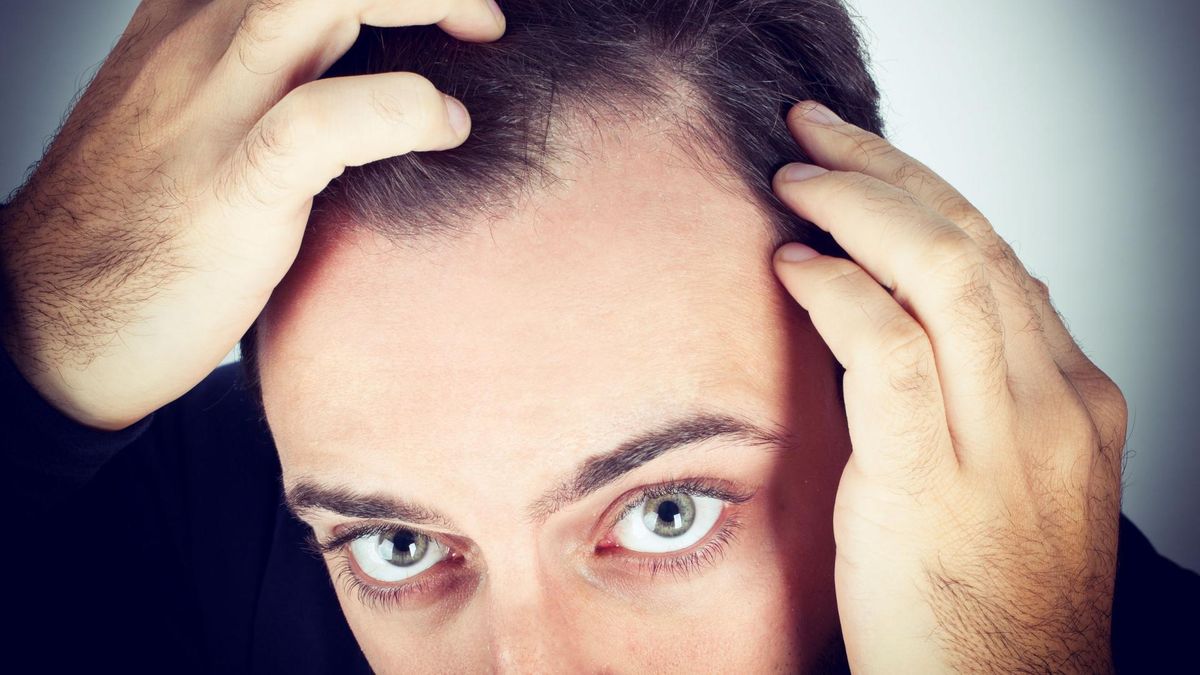 Objawy łupieżu nie są trudne do zaobserwowania