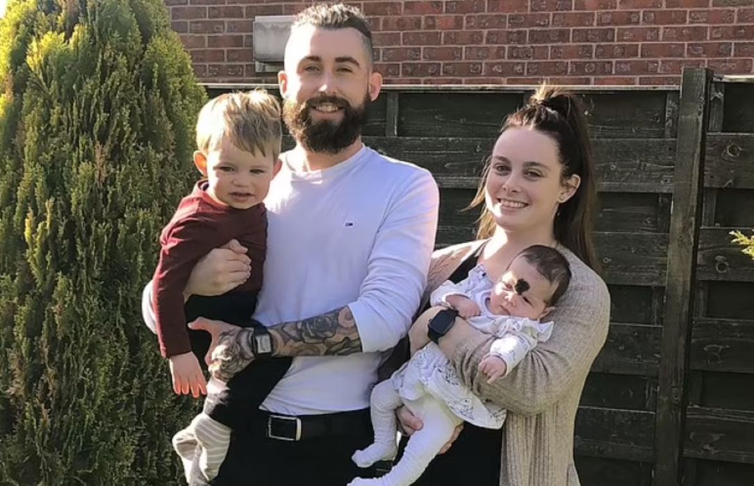 Dziewczynka urodziła się z ogromnym znamieniem na czole. Lekarze nie chcą go usunąć