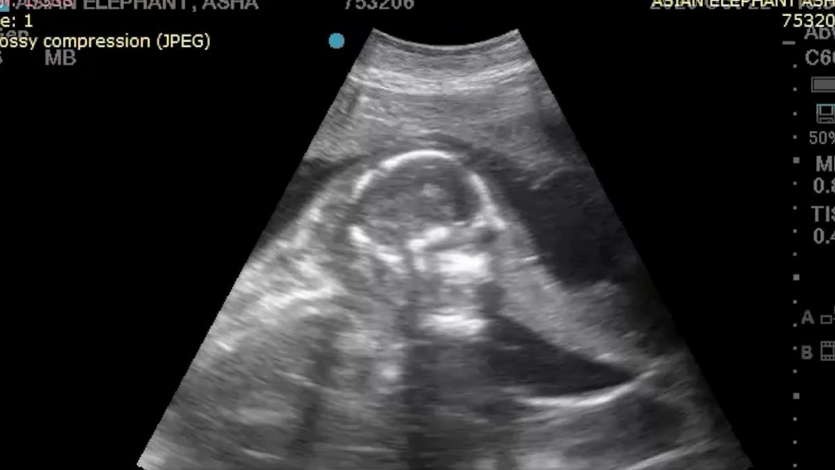 Nagranie z USG słonia stało się hitem internetu. Mały słonik jest uroczy! 1