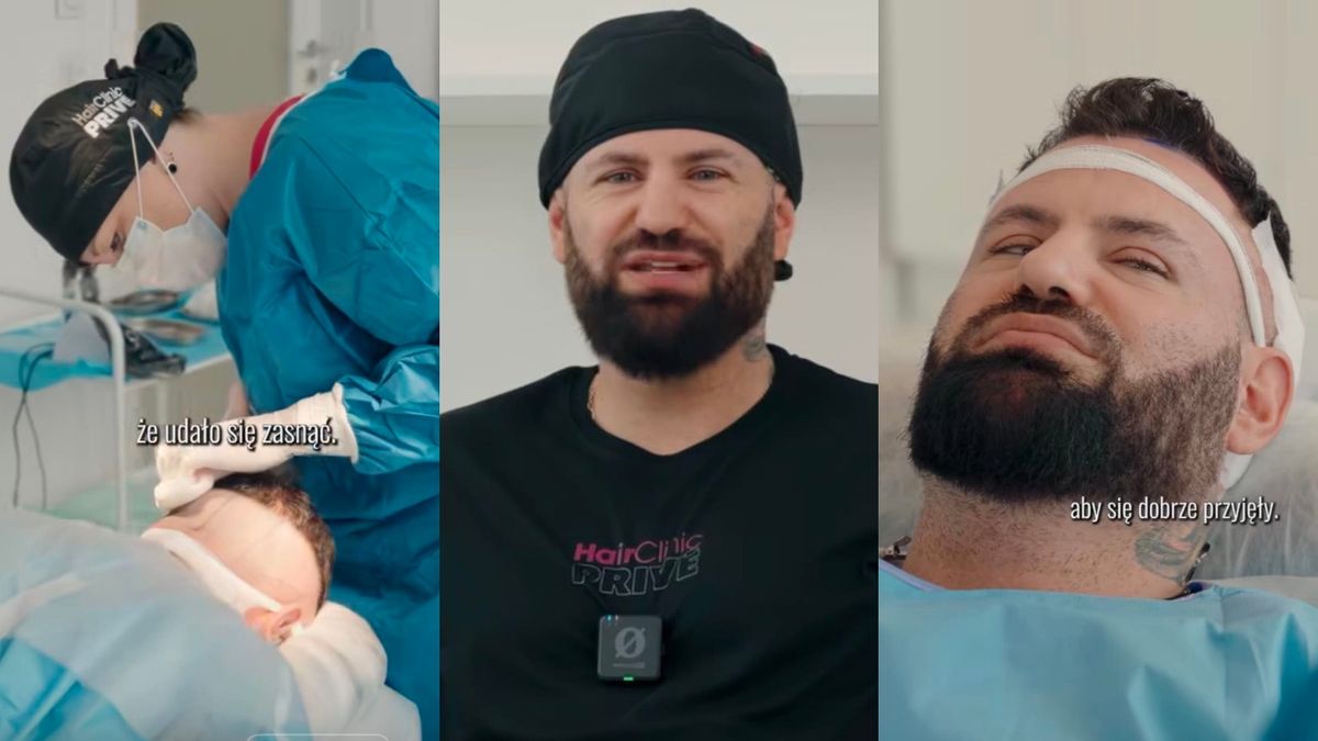Wojtek Gola zafundował sobie PRZESZCZEP WŁOSÓW