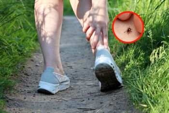 Wysmarkuj kostki przed wyjściem do lasu. Kleszcze nawet się nie zbliżą