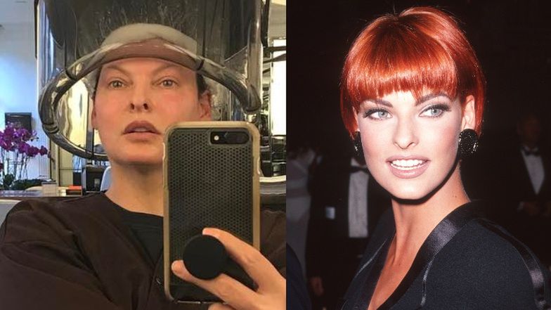 Linda Evangelista zarzuca specjalistom od medycyny estetycznej, że zdeformowali jej twarz 
