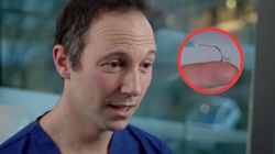 Zastrzyk, który ratuje wzrok. Nowa terapia ma szansę pomóc setkom pacjentów