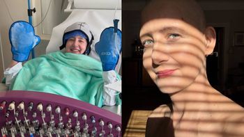 Monika Mikuła kilka tygodni temu zaniepokoiła fanów zdjęciem ze szpitala. Teraz aktorka pokazała się bez włosów (FOTO)