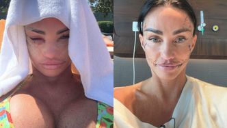 Katie Price pokazała, jak zmieniała się jej twarz po SZÓSTYM liftingu. Internauci nie dowierzają: "Niszczysz siebie"