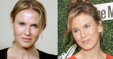 Renee Zellweger odstawiła botoks? (ZDJĘCIA)