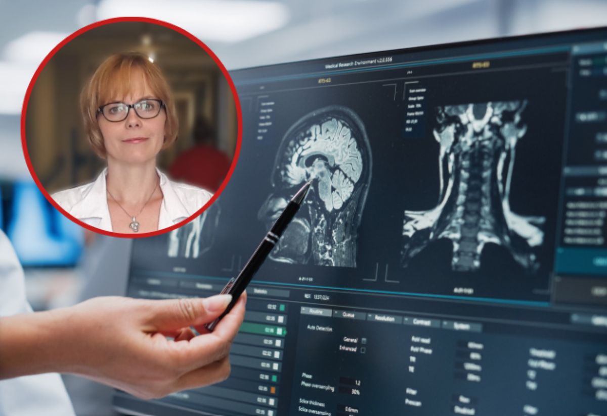 Polska nieprzygotowana na te wyzwania. Neurolodzy alarmują