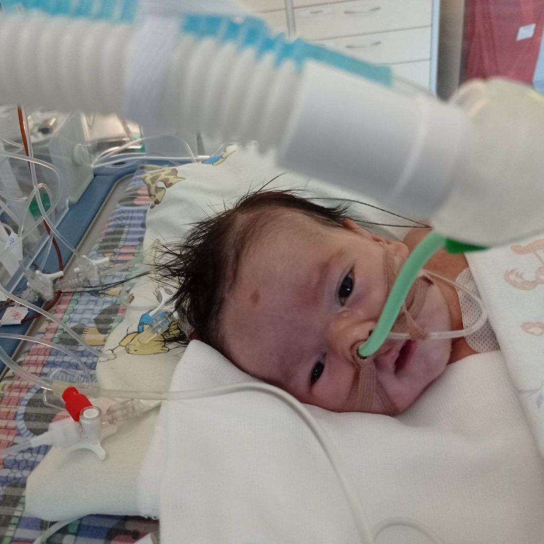 &quot;W wieku pięciu tygodni Karolinka przeszła drugie cewnikowanie serca&quot;