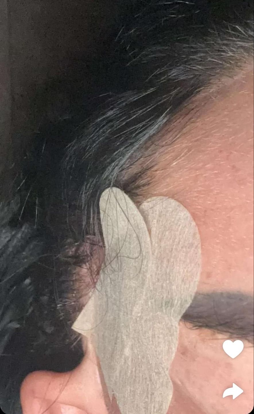 Katie Price prezentuje kulisy kolejnej operacji w Turcji
