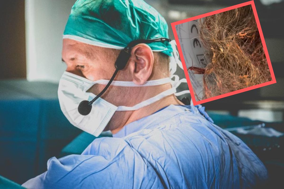 "Pół wiaderka". Lekarz pokazał, co usunęli z wraz z guzem