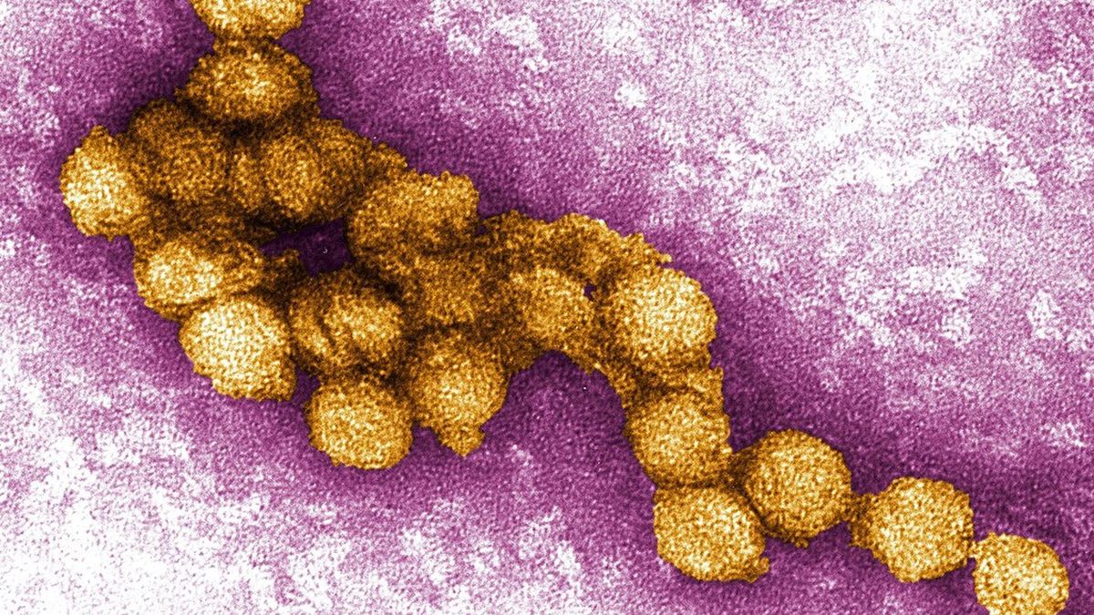 Wirus Zachodniego Nilu