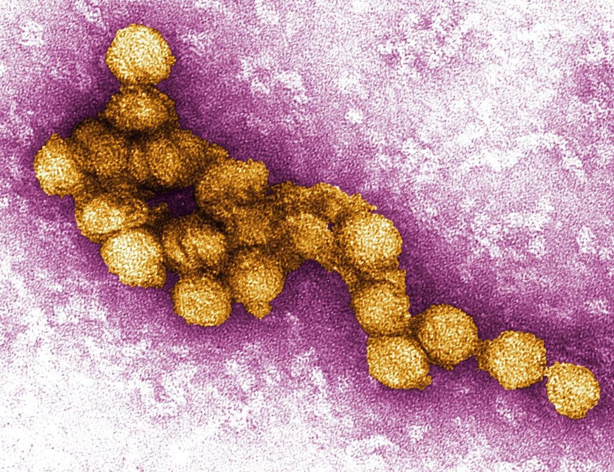 Groźny wirus atakuje w Europie. W Holandii pierwszy przypadek w historii
