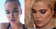 Internauci krytykują "nowe usta" Khloe Kardashian: "Są przesadzone, wyglądają paskudnie"