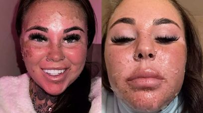 Influencerka popamięta to do końca życia. Tak urządziła się na solarium