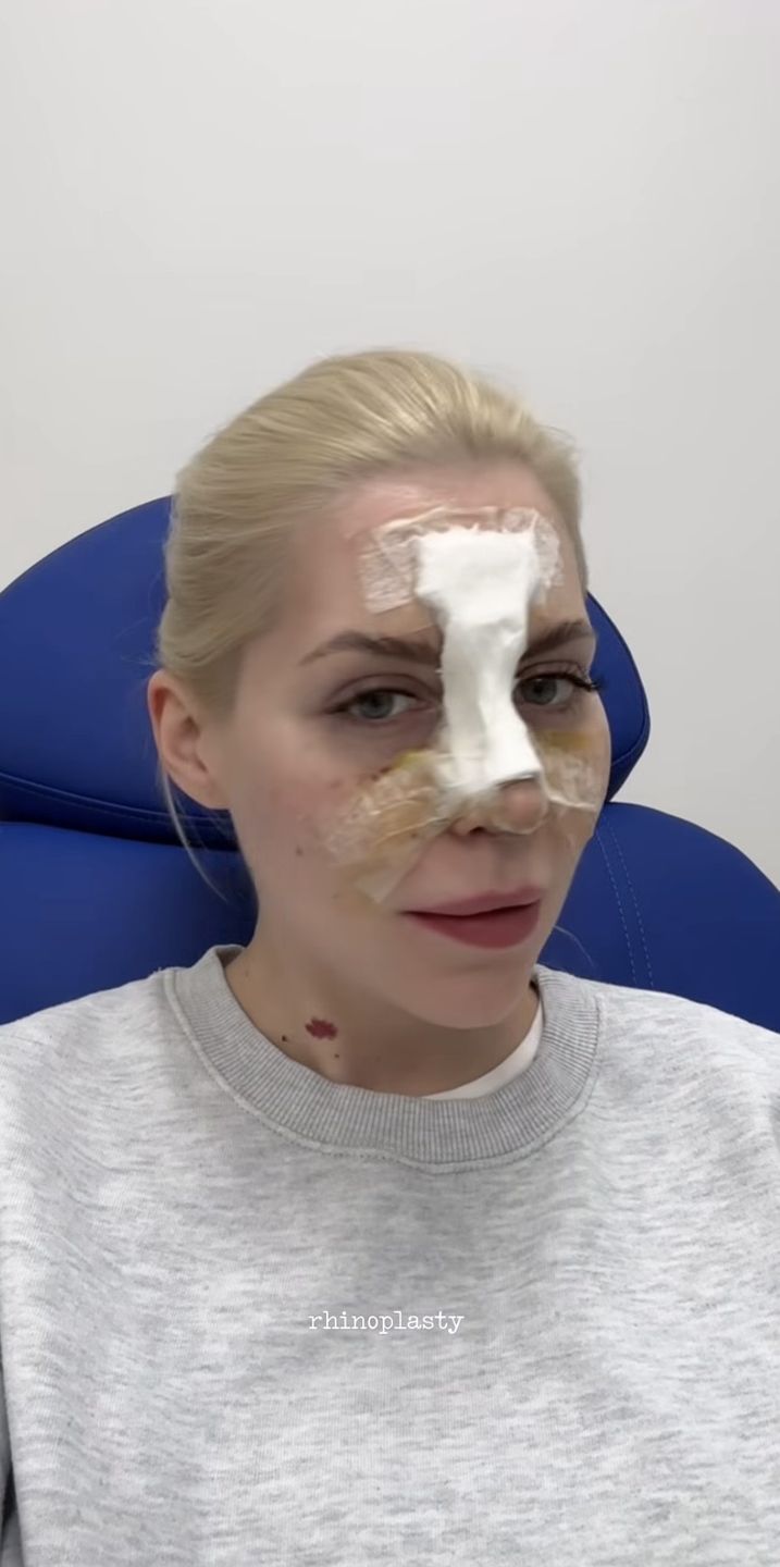 Julia von dokumentuje rekonwalescencję po zabiegach 