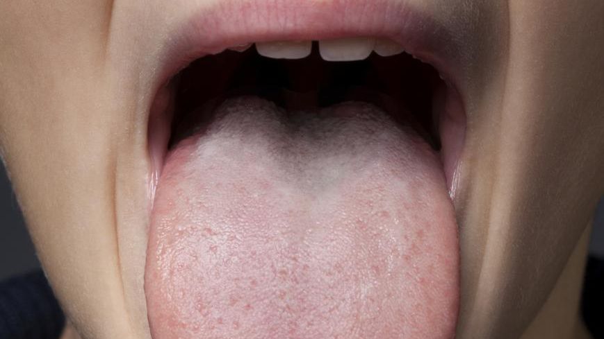 Do szpitali trafia coraz więcej dzieci z COVID-19