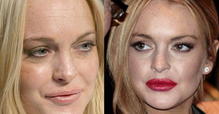 Lohan: "Nie miałam powiększanych ust!" KŁAMIE?
