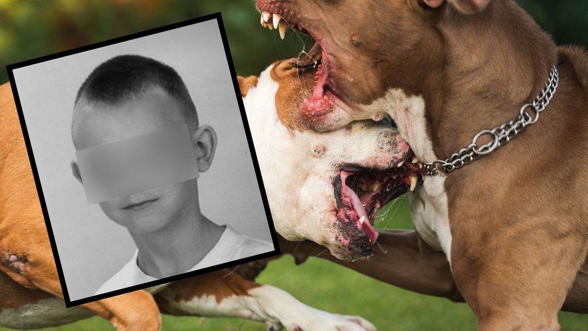 12-letni Kamil został zagryziony przez agresywnego pitbulla 