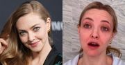 Amanda Seyfried choruje na egzemę. Zmyła makijaż i pokazała, jak naprawdę wygląda jej cera