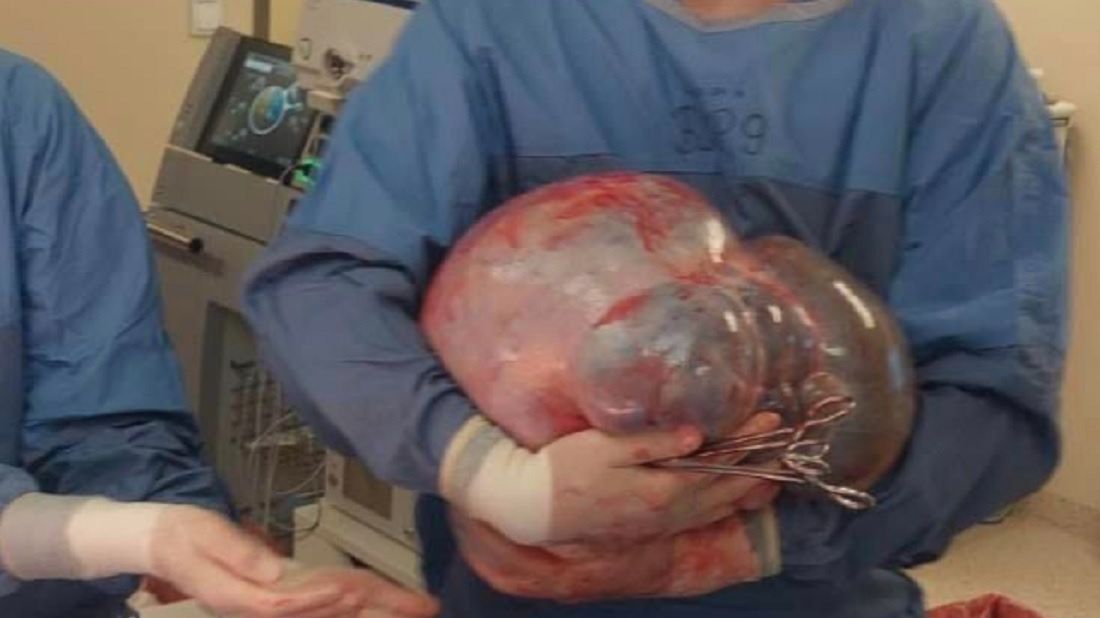 16-kilogramowy potworniak z Białegostoku.