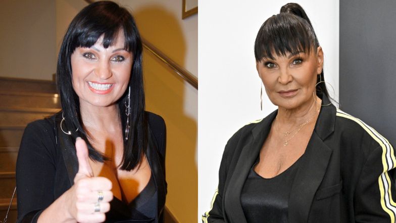 Iwona Pavlović wiele lat temu poddała się plastyce nosa