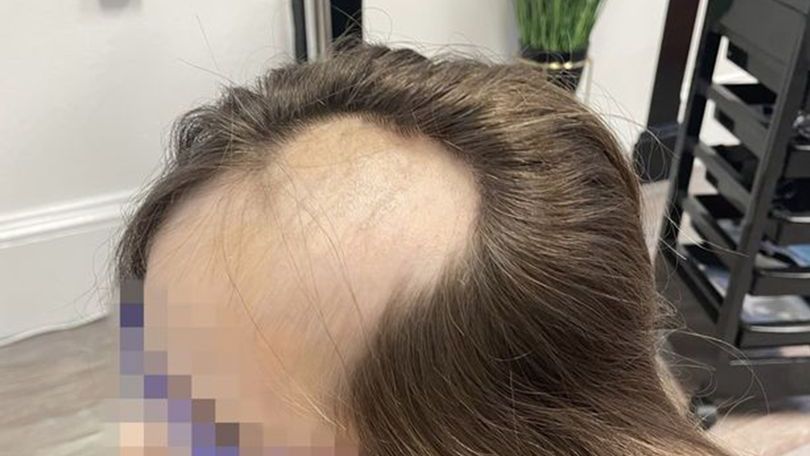 Nachyliła się nad mikserem. Dziewczynka straciła włosy