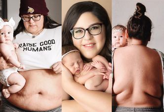Matka z Teksasu pokazuje "prawdę o ciele po ciąży", w której przytyła prawie 30 kilogramów! (ZDJĘCIA)