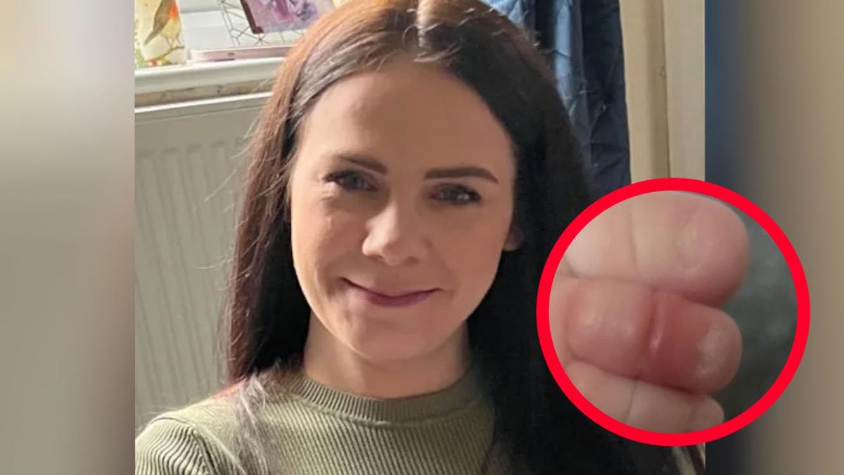 Mama ostrzega innych rodziców. Jej synek prawie stracił palce