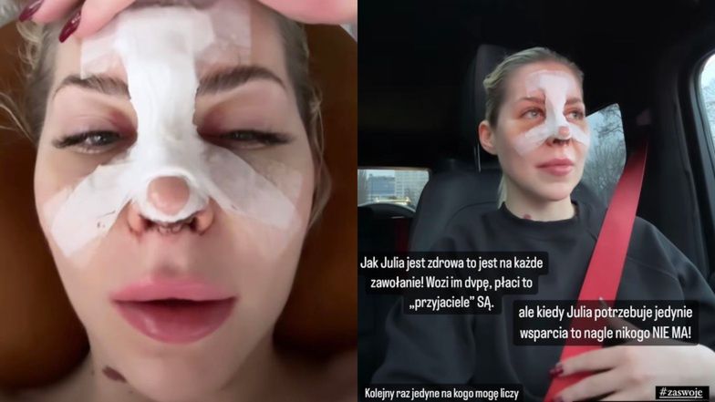 Julia von Stein porzucona przez przyjaciół po operacji nosa