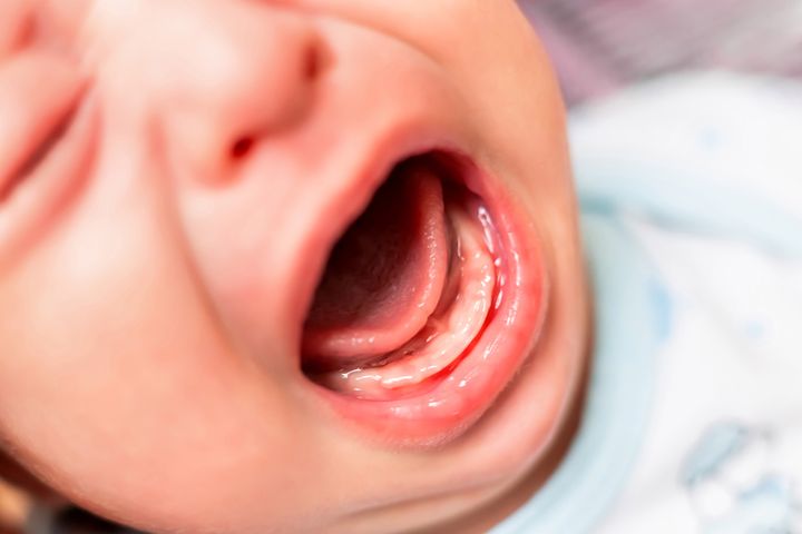 Potrząsanie niemowlakiem może doprowadzić do wylewu krwi do mózgu, trwałego uszkodzenia mózgu albo uszkodzenia kręgosłupa szyjnego dziecka. 