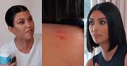 Poturbowana przez siostrę Kim Kardashian prezentuje RANY na ciele. Kourtney odejdzie z programu?! "NIE CHCĘ BYĆ OBOK TWOJEJ GRUBEJ D*PY" (WIDEO)