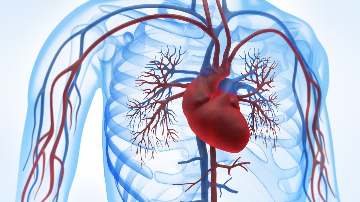 Krążenie hiperkinetyczne może wystąpić w przypadku ciężkich zakażeń bakteryjnych krwi.
