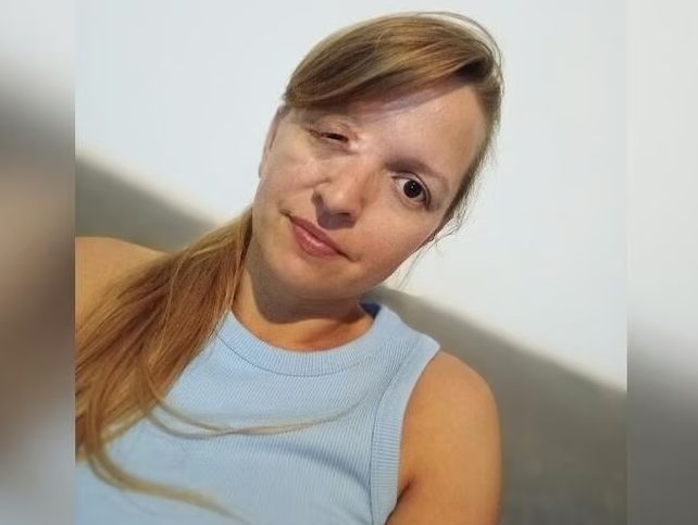 Kasia wciąż odczuwa skutki wypadku