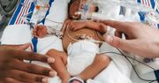 Mały Cassian urodził się dwa razy. Wystawała mu tylko głowa i ramiona