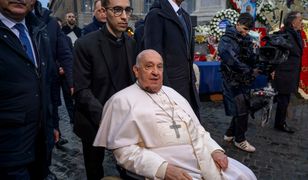 Papież Franciszek z siniakiem na twarzy. Watykan wyjaśnia