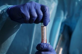 Polska firma wprowadza szybkie testy na COVID-19. Wynik w 6 minut