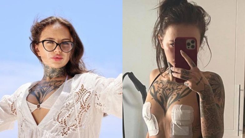 Klaudia z "Hotelu Paradise" po operacji plastycznej