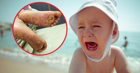 Dziewczynka poparzyła się na plaży. Dwulatka trafiła do szpitala