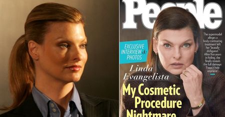 Linda Evangelista pokazała NOWE ZDJĘCIE zdeformowanego ciała: "Jak chodzę w sukience, obcieram się niemal do krwi"